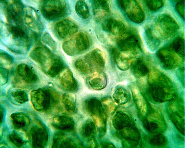 В клетках водорослей содержится. Клетка водоросли. Клетка ламинарии. Клетка бурых водорослей. Хлорофилл в клетках водорослей.